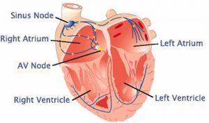 How does a Leadless Pacemaker works