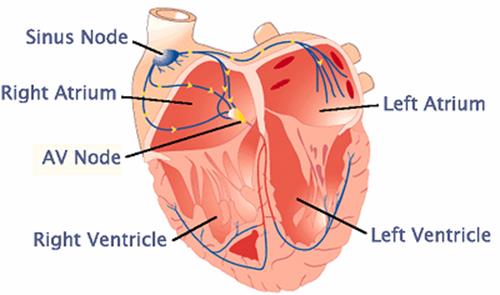 How does a Leadless Pacemaker works