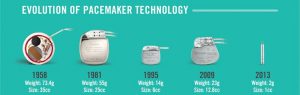 Leadless Pacemaker technology